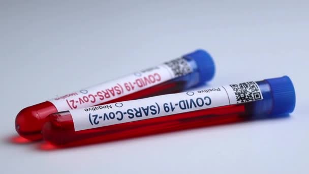 Flasks Blood Tests Coronavirus Positive Negative Mpox — Stock videók