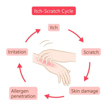 Kaşındıran el illüstrasyonu. Kuru, dermatit ve atopik egzama durumu. Sağlıklı cilt bakımı kavramı