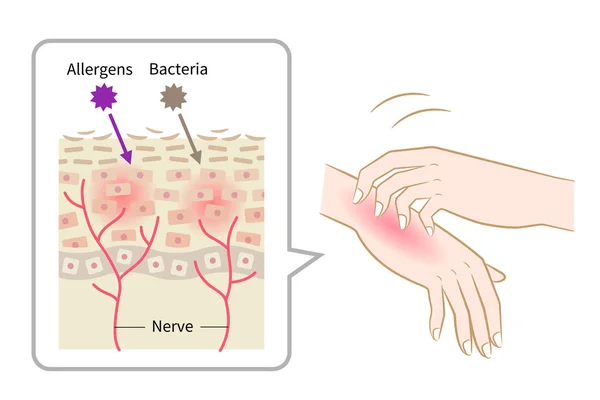scratching itch hands. redness rash and skin cell illustration. Healthy skin care concept