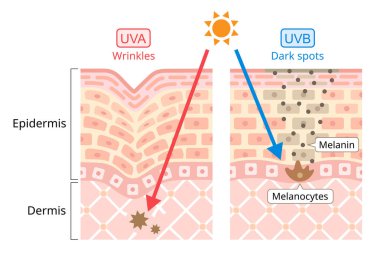 UVA ve UVB insan derisine zarar verir. Ultraviyole A (UVA) daha uzun bir dalga boyuna sahiptir. Salyangozlarla ilişkilendirilir. Ultraviyole B (UVB) daha kısa bir dalga boyuna sahiptir. Karanlık Nokta ile ilişkilendirilir. Güzellik ve sağlık hizmeti konsepti