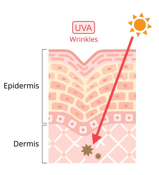 Uva损伤人类皮肤 紫外线A Uva 的波长较长 它与Winkles有关 美容美发护理概念 — 图库矢量图片