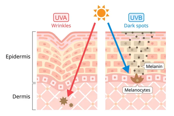 Uva和Uvb损伤人类皮肤 紫外线A Uva 的波长较长 它与Winkles有关 紫外线B Uvb 的波长较短 它与黑斑有关 美容美发护理概念 — 图库矢量图片