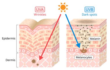 UVA ve UVB insan derisine zarar verir. Ultraviyole A 'nın dalga boyu daha uzundur. Salyangozlarla ilişkilendirilir. Ultraviyole B 'nin dalga boyu daha kısadır. Karanlık Nokta ile ilişkilendirilir. Güzellik ve sağlık hizmeti konsepti