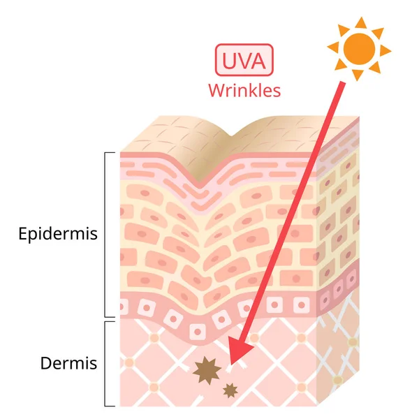 Uva损伤人类皮肤 Uva导致绞车 美容美发护理概念 — 图库矢量图片