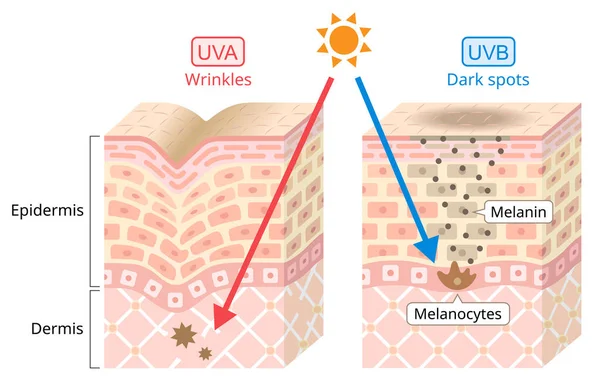 UvaとUvbは人間の皮膚にダメージを与えます 紫外線Aは波長が長い ウィンクルズと関連がある 紫外線Bは波長が短い 暗斑と関連がある 美容とヘルスケアのコンセプト — ストックベクタ