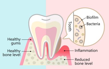 Diş biyofilmi ve sağlıklı diş. Diş sağlığı ve sağlık hizmetleri kavramı
