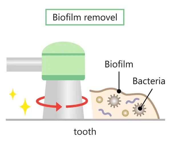 Zubní Biofilmy Odstraňují Ilustraci Koncepce Stomatologické Ústní Péče — Stockový vektor