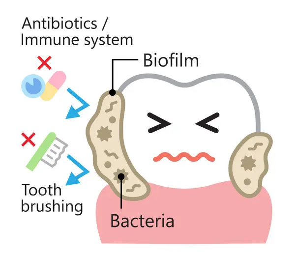 Tandheelkundige Biofilm Schattig Karakter Illustratie Bacteriën Plaque Bevestiging Tand Tandheelkundige — Stockvector