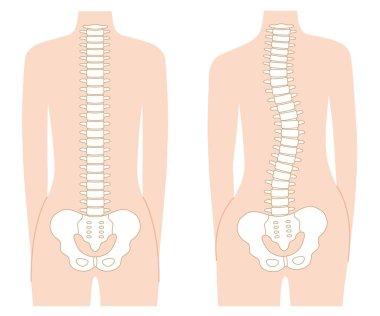 düz insan omurgası çizimi. Sağlık ve tıbbi konsept