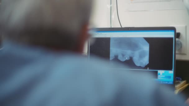 獣医師は 歯科X線でスクリーンモニターを見ています スローモーション — ストック動画