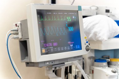 Display of a hospital cardiac machine in a hospital room