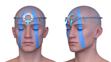 Bir adamın yüzünün 3 boyutlu görüntüsü.