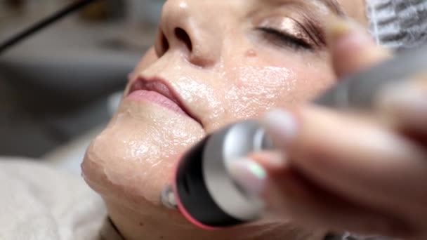 Beautician Utför Ansiktsradiofrekvens Ansökan För Melasma Behandling Hos Kvinnlig Patient — Stockvideo
