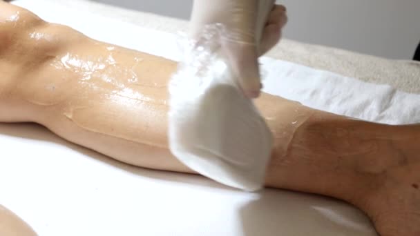 Kosmetička Odstraňuje Chlupy Ženských Nohou Laserové Ošetření Odstranění Vlasů Salonu — Stock video