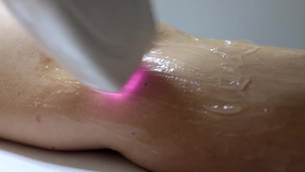 Beautician Αφαιρεί Μαλλιά Στα Γυναικεία Πόδια Θεραπεία Αφαίρεσης Τρίχας Λέιζερ — Αρχείο Βίντεο