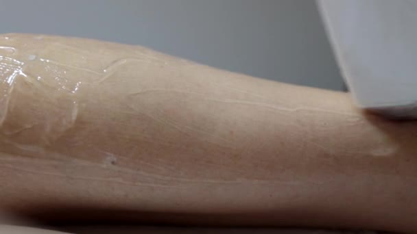Esteticista Remove Cabelo Pernas Femininas Tratamento Depilação Laser Salão Beleza — Vídeo de Stock