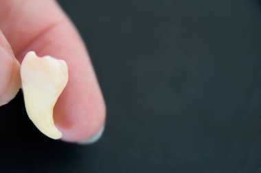 Caucasian human hand holding a cheektooth. Black background