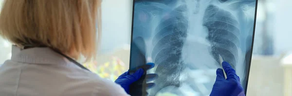 Lékař Diagnostikuje Zdravotní Stav Pacienta Astmatem Plicními Onemocněními Covid Rentgen — Stock fotografie
