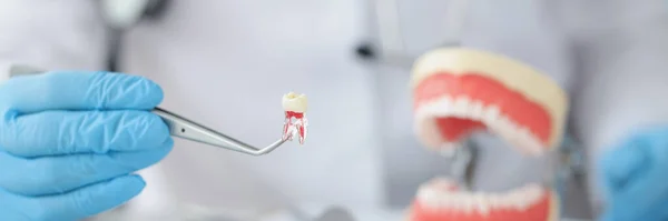 Dentist is holding tooth and dental tool. Installation of dental implants concept