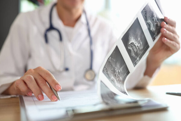 Close-up of female doctor looking at description of ultrasound shots of patient. Medicine, healthcare and treatment concept