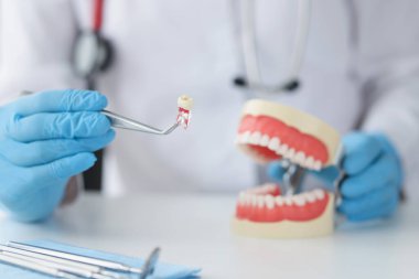 Diş hekiminin cımbızla dişini tuttuğu ve çene modelini gösterdiği yakın plan. Diş sağlığı ocağı ve diş kaplaması kurulumu
