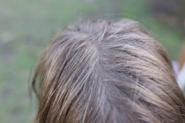 Su damlalarının ya da çocukların saçındaki kepeğin üst görüntüsü. Çocuk başının üzerinden akan sudan hoşlanıyor. Boş zaman ve eğlence konsepti. Hijyen fikri