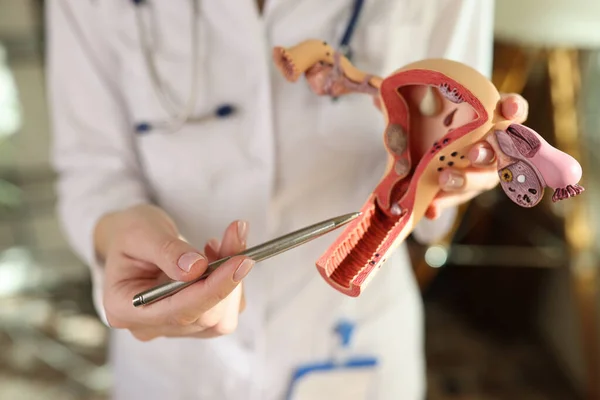 Doctor Gynecologist Explaining How Female Genital Organs Arranged Artificial Uterus — Stock Photo, Image