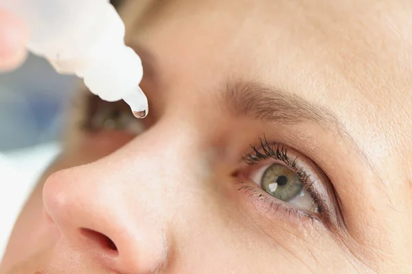 Close-up of middle age woman face and dripping eye drops. Treatment of conjunctivitis, allergy and dry eye syndrome.