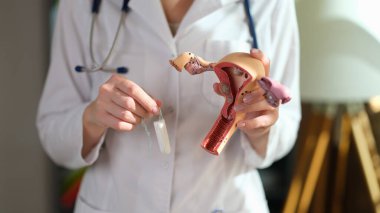 Doktorlar rahim modelini ve tamponu yakın plan çekimde tutuyorlar. Kadın hijyeni, jinekoloji.