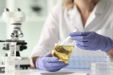 Close-up of scientist woman holding sample with yellow liquid. Testing of sample and laboratory concept