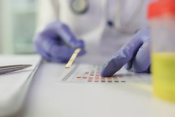 Close-up of doctor checking medical test results at desk in medical clinic. Scientist compares color of control paper sample and list of many samples.
