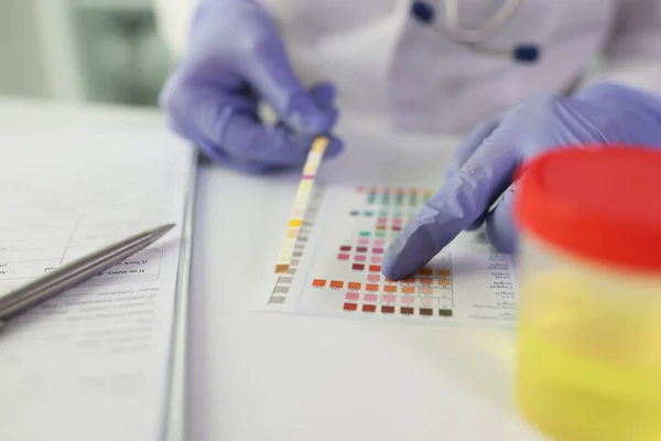 Funcionário Laboratório Verifica Resultados Teste Urina Paciente Olhando Para Paleta — Fotografia de Stock