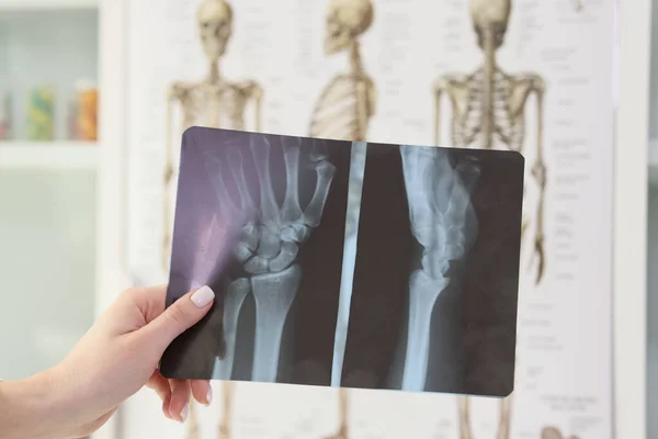 Hand of woman holding x-ray of wrist against skeletons in doctor office. Professional checkup of condition of bones and joints in hospital closeup