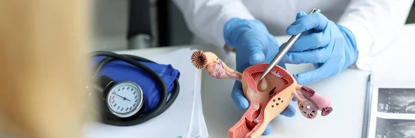 Gynecologist Doctor Shows Pen Plastic Model Uterus Ovaries Woman Clinic — Stock Photo, Image