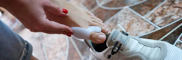 Close-up of woman applying brace for hallux valgus and putting on sneaker. Deformity of joints of foot concept