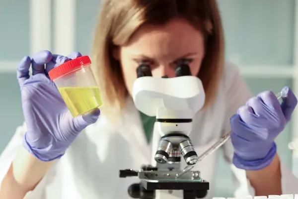 女性は顕微鏡を見る 実験室の助手は 背景がぼやけている黄色の液体を含むプラスチック容器を保持する分析のための尿サンプルを調べる — ストック写真