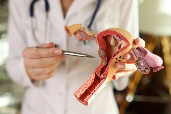 Gynecologist Points Pen Anatomical Model Uterus Hand Specialist Medical Uniform — Stock Photo, Image