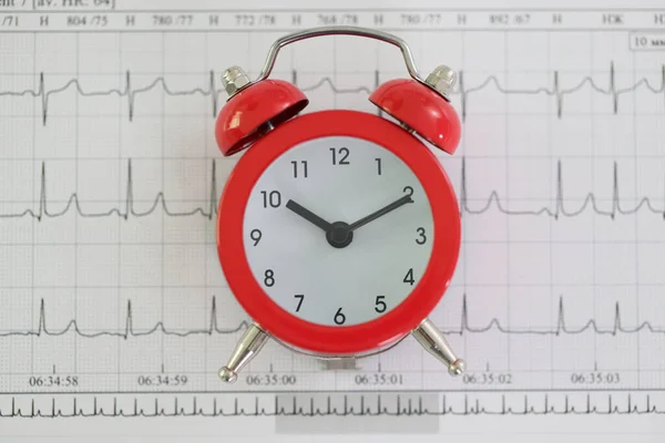Oldtimer Wecker Steht Der Klinik Gegen Kardiogrammpapier Detaillierte Herzfrequenzüberwachung Krankenhaus — Stockfoto