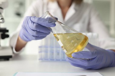 Lastik eldivenli kadın bilim adamı elinde yağlı cam şişeyle masada oturuyor. Kadın laboratuarda muayene için sarı sıvı hazırlıyor.