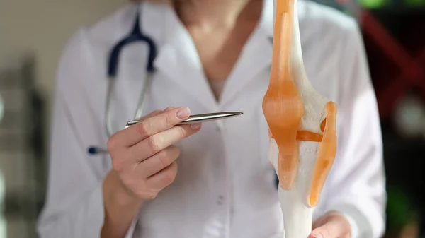 Close Médico Mulher Demonstrando Modelo Anatomia Humana Joelho Articulação Joelho — Fotografia de Stock