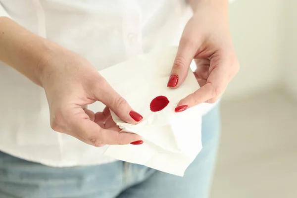 Женщина Держит Бумажные Салфетки Пятном Крови Светлой Комнате Леди Показывает — стоковое фото