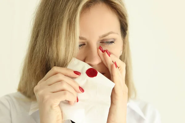 女性は軽い部屋で紙ナプキンで鼻出血を拭く 女性は外傷後の血液を止めるために組織を使用した 痛風治療 — ストック写真