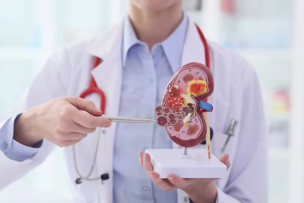 Stock image Doctor points pen to artificial model of kidney with stones in premise. Specialist demonstrates structure and diseases of human for students at lesson