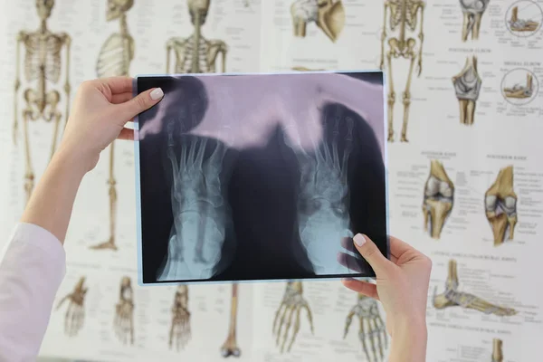 Doktor Drží Rentgenový Snímek Pacientových Nohou Proti Anatomickým Štítkům Klinice — Stock fotografie