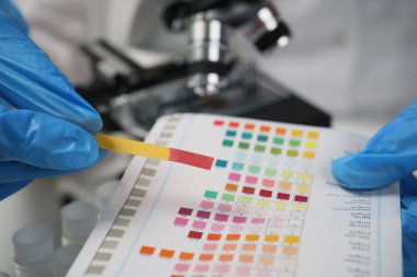 Eldivenli laboratuvar çalışanı asit ölçümü için özel çubuğun rengini gösterge kağıdıyla karşılaştırır. Aygıtın ucu mor renktedir