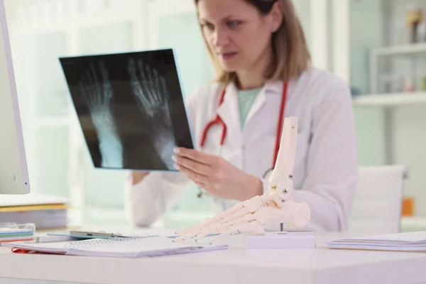 穿着工作服的女医生坐在现代诊所办公室的工作场所 在人体足模旁边用X光检查骨头损伤情况 骨骨折概念 — 图库照片