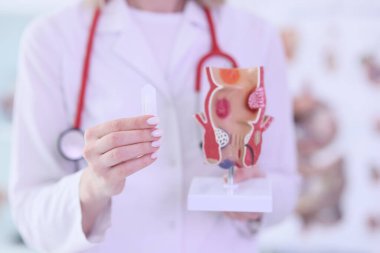 Steteskoplu genç bayan doktor hasta rektum resmi gösteriyor. Uzman, rektal kanser tehlikesi konusunda uyarıyor. Sağlık ve Tedavi Konsepti