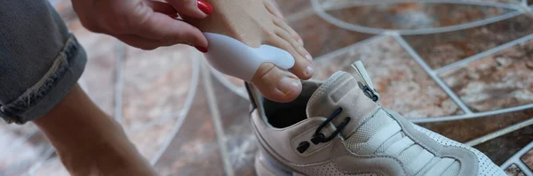 Close Female Using Brace Hallux Valgus Puts Sneaker Podiatric Medicine — Fotografia de Stock