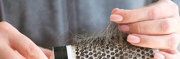 Close-up of woman hands holding comb with hair loss. Health care and medical. Hair loss problem concept