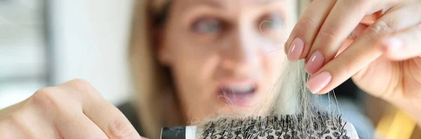 Проблема Випадіння Волосся Нездорове Волосся Розчарована Перелякана Біла Жінка Тримає — стокове фото